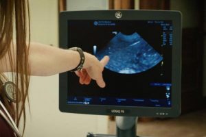 Procedure of ultrasound examination